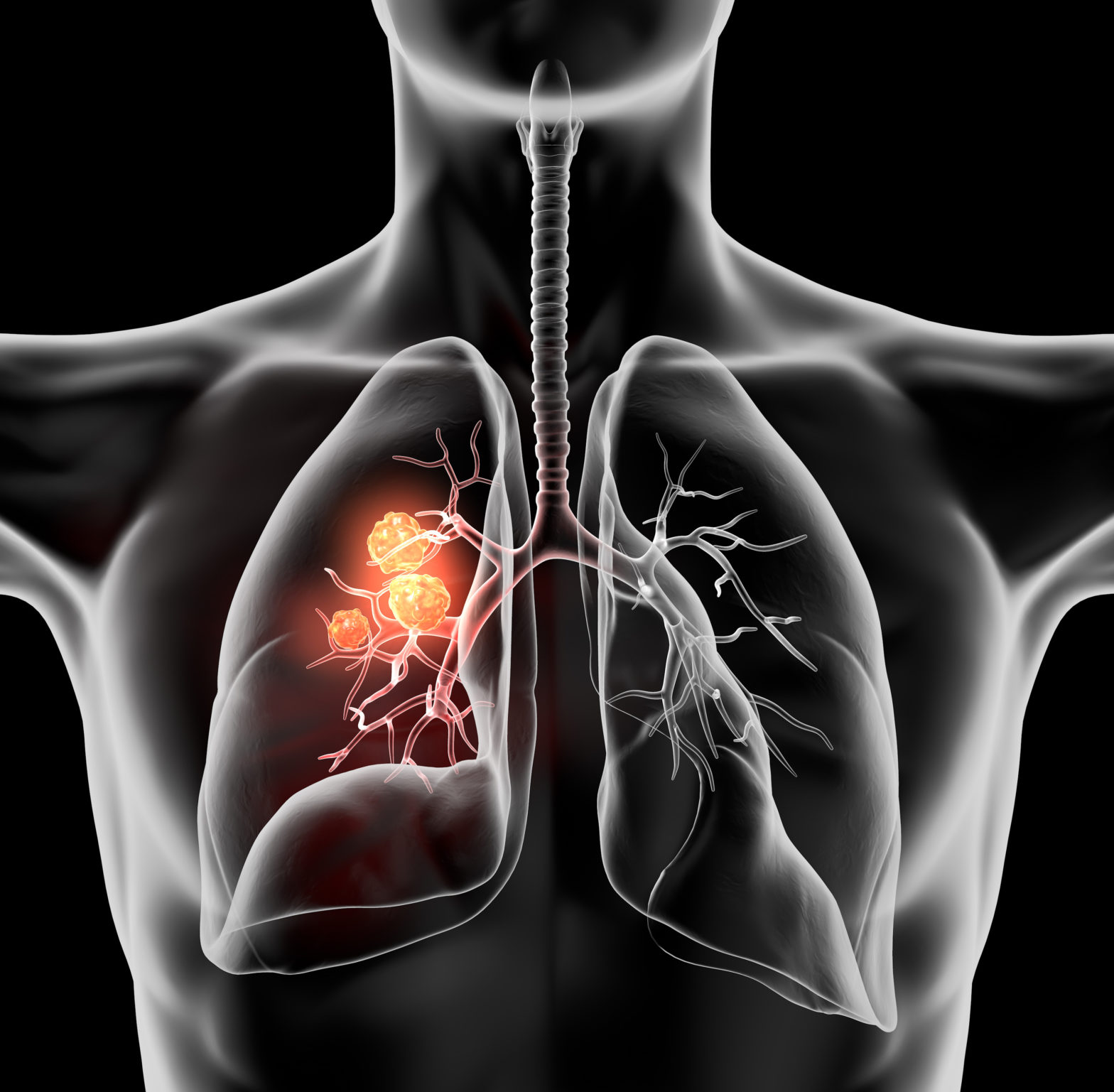 Advanced Lung Imaging – Magnetic Resonance Imaging and Artificial ...