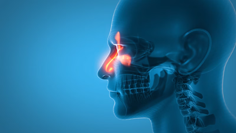 EVEREST Trial Reveals Dupilumab’s Superiority Over Omalizumab in CRSwNP with Asthma